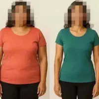 ماساژ کاهش وزن و فرم دهی