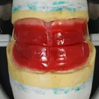 میخای تو 30 جلسه دندانسازی رو آموزش ببینی|خدمات آموزشی|ارومیه, |دیوار