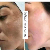 کرم اماراتی vip|آرایشی، بهداشتی، درمانی|جیرفت, |دیوار