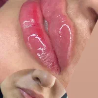 ژل و بوتاکس|خدمات آرایشگری و زیبایی|شوشتر, |دیوار