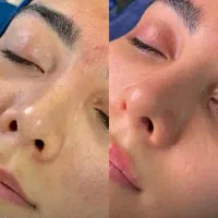 فیشیال پاکسازی|خدمات آرایشگری و زیبایی|چغادک, |دیوار