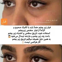 جشنواره پک مادلینگ +بوتاکس رایگان(فک لب گونه چانه)|خدمات آرایشگری و زیبایی|قم, زنبیل آباد|دیوار