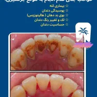 انجام جرمگیری هر فک فقط ۴۵۰ تومان در مطب شخصی