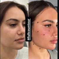 پوست صاف|خدمات آرایشگری و زیبایی|تهران, قبا|دیوار