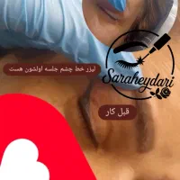 پاککردن تاتو صورت و بدن.تخفیف تا پایان هفته|خدمات آرایشگری و زیبایی|کرمانشاه, |دیوار
