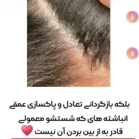درمان قطعی موخوره و ریزش مو رایگان شد.|خدمات آرایشگری و زیبایی|رشت, کوی بیانی|دیوار
