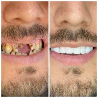 ترمیم و زیبایی|خدمات آرایشگری و زیبایی|یاسوج, |دیوار