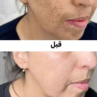 اصلی ترین کرم معجزه وی ای پی گیاهی