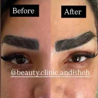 جراحی زیبایی بلفاروپلاستی،مینی لیفت صورت|خدمات آرایشگری و زیبایی|اندیشه, اندیشه فاز ۱|دیوار