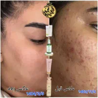 مشاوره پوست و مو و صورت