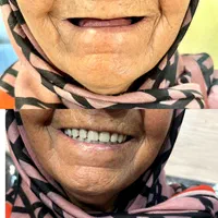 کلنیک دندانپزشکی ودندانسازی، دندان مصنوعی|خدمات آرایشگری و زیبایی|شیراز, سیاه سنگ|دیوار
