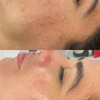 آموزش حرفه ای فیشال با شرط شروع به کار