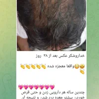 تونیک تقویت کننده مو رشد مجدد|آرایشی، بهداشتی، درمانی|تربتحیدریه, ۴۵ متری|دیوار