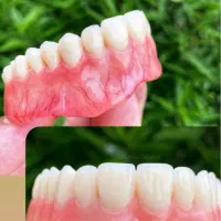 ساخت دندان مصنوعی|خدمات آرایشگری و زیبایی|اردبیل, |دیوار