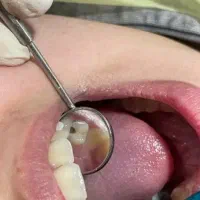 دندانپزشکی جهاد دانشگاهی خیریه