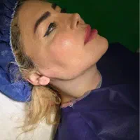 جشنواره غبغب بلفارو ژل بوتاکس جوانساز پی ار پی مزو