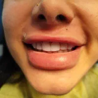 جشنواره کامپوزیت 8000 م ،عصب کشی از۲۵۰۰ توسط پزشک|خدمات آرایشگری و زیبایی|رشت, دروازه لاکان|دیوار