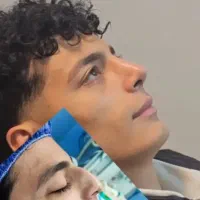 عمل بینی بدون تامپون فقط ۳۰ تومن با روش مدرن