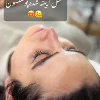 مدل فیشال و پاکسازی|خدمات آرایشگری و زیبایی|شیراز, آزادگان|دیوار