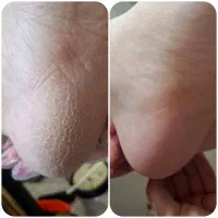 پدیکور با قیمتی مناسب|خدمات آرایشگری و زیبایی|رشت, معلم|دیوار