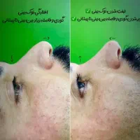 اف ویژه تمام خدمات زیبایی و جراحی در مطب|خدمات آرایشگری و زیبایی|یاسوج, |دیوار