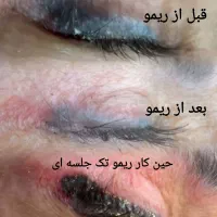 ریمو ابرو،چشم ولب|خدمات آرایشگری و زیبایی|تهران, افسریه شمالی|دیوار
