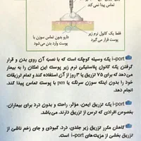 آی. پورت تزریق انسولین بدون سوزن و درد|آرایشی، بهداشتی، درمانی|تهران, دریان‌نو|دیوار