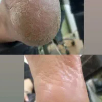 پدیکور و پاکسازی صورت و دست