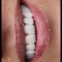 دستیار دندان پزشک حرفه ای