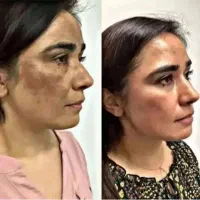 پادزهر کرم معجزه