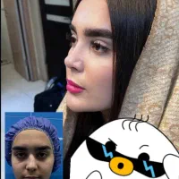 مرکزفوق تخصصی جراحی بینی/وجشنواره۱۰روزهشگفت انگیز|خدمات آرایشگری و زیبایی|مشهد, احمدآباد|دیوار