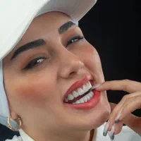 دندان کامپوزیت دندانپزشکی|خدمات آرایشگری و زیبایی|مشهد, دانشجو|دیوار
