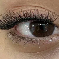 کاشت مژه