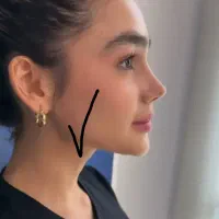 ۵ نفر عمل بینی ۱۵ میلیون باجراح و فوق تخصص پلاستیک