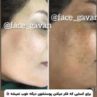 بزرگترین غول ۸کاره جهان|آرایشی، بهداشتی، درمانی|شیراز, کفترک|دیوار