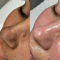 جشنواره پاییزی با کلی تخفیف روی خدمات|خدمات آرایشگری و زیبایی|اهواز, گلستان|دیوار