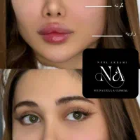 ژل لب و فول فیس ۳۷۰هزار تومان توسط پزشک کلینیک|خدمات آرایشگری و زیبایی|کرج, گوهردشت|دیوار