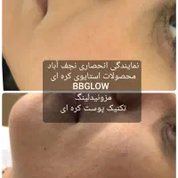 فیشیال مزوتراپی(کرم پودردائم)مرکززیبای تعرفه دولتی|آرایشی، بهداشتی، درمانی|نجفآباد, بازار|دیوار