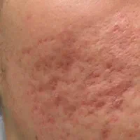 دکتر پوست خوب معرفی کنید