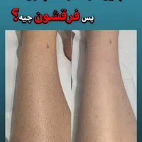 لیزرموهای زائد*ویژه بانوان*رایگان|خدمات آرایشگری و زیبایی|اصفهان, بوستان آینه خانه|دیوار