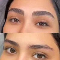 فیبروز ابرو