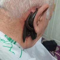 حجامت،زالودرمانی،فصد،برداشت خال و زگیل،در کل شهر|خدمات آرایشگری و زیبایی|مشهد, الهیه|دیوار