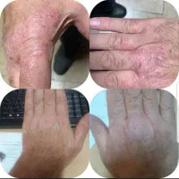 پاکسازی پوست