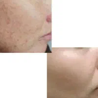 مشاوره پوست ومو|آرایشی، بهداشتی، درمانی|محمدیه-قزوین, |دیوار