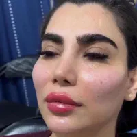پاکسازی و جوانسازی صورت