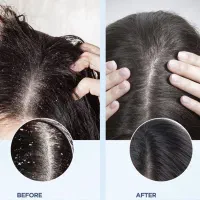 اموزش اسکراب اسکالپ تخصصی با مدرک و خدمات اسکراب|خدمات آرایشگری و زیبایی|تهران, میرداماد|دیوار
