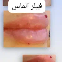 آف پنجاه درصد ژل و بوتاکس با بهترین برند|خدمات آرایشگری و زیبایی|اهواز, شریعتی جنوبی|دیوار