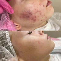 نیازمند مدل پاکسازی فقد هزینه متریال گرفته میشه
