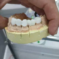 آموزش دندانپزشکی کامپوزیت|خدمات آموزشی|تهران, شهرک شریعتی|دیوار