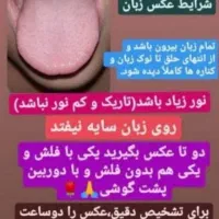شناخت بیماری از روی عکس زبان شما